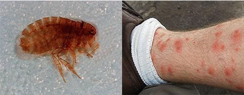 Sand fleas and their bites: photo